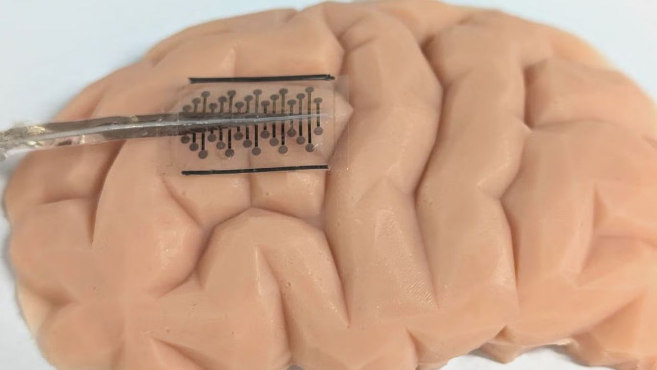 94bebb6d-EPILEPSY1.jpg?t=7cTGIDUrbSDPj5p