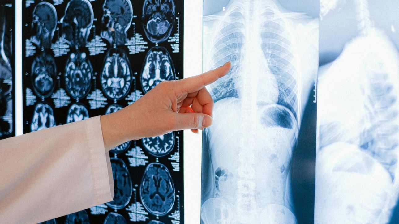 Z&omega;&nu;&tau;&alpha;&nu;ό&sigmaf; &chi;&omega;&rho;ί&sigmaf; &pi;&nu;&epsilon;ύ&mu;&omicron;&nu;&epsilon;&sigmaf; &gamma;&iota;&alpha; 48 ώ&rho;&epsilon;&sigmaf;: Ά&nu;&delta;&rho;&alpha;&sigmaf; &epsilon;&pi;&iota;&beta;ί&omega;&sigma;&epsilon; &mu;&epsilon; &tau;&epsilon;&chi;&nu;&eta;&tau;&omicron;ύ&sigmaf; &mu;έ&chi;&rho;&iota; &tau;&eta; &mu;&epsilon;&tau;&alpha;&mu;ό&sigma;&chi;&epsilon;&upsilon;&sigma;&eta;