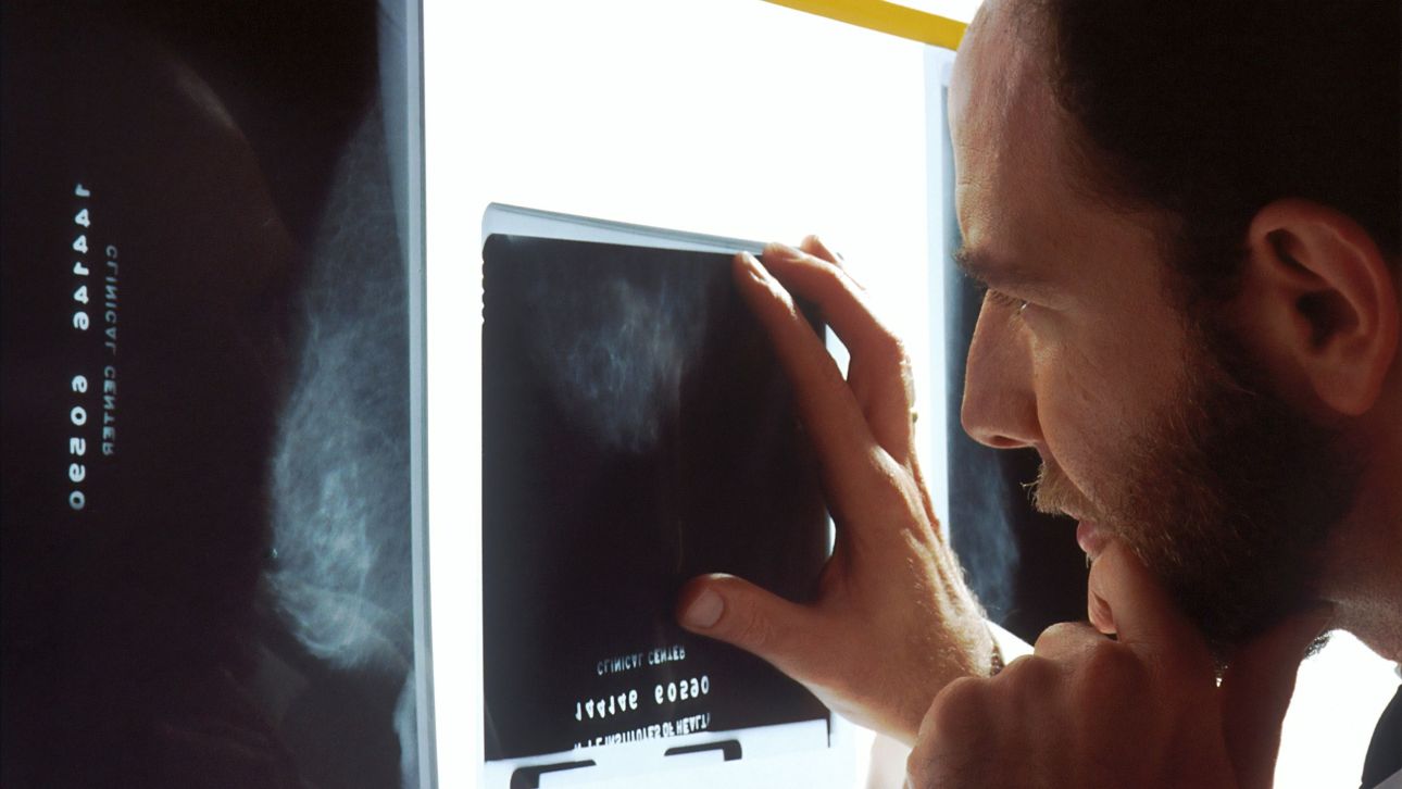 &Nu;έ&alpha; έ&rho;&epsilon;&upsilon;&nu;&alpha;: &Tau;&omicron; AI &mu;&pi;&omicron;&rho;&epsilon;ί &nu;&alpha; &pi;&rho;&omicron;&beta;&lambda;έ&psi;&epsilon;&iota; &sigma;&omicron;&beta;&alpha;&rho;έ&sigmaf; &kappa;&alpha;&rho;&delta;&iota;&alpha;&kappa;έ&sigmaf; &pi;&alpha;&theta;ή&sigma;&epsilon;&iota;&sigmaf; &sigma;&tau;&iota;&sigmaf; &mu;&alpha;&sigma;&tau;&omicron;&gamma;&rho;&alpha;&phi;ί&epsilon;&sigmaf;