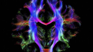 Wellcome Image Awards 2016: Οι 20 βραβευμένες φωτογραφίες επιστήμης και ζωής