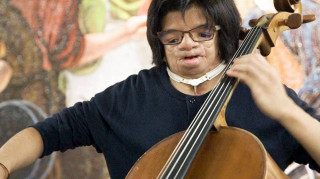 Ο τσελίστας με τη σπάνια κρανιοπροσωπική δυσμορφία που μαγεύει το μετρό της Νέας Υόρκης