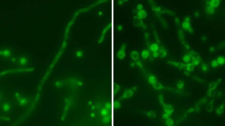 Ιός «μπάμπουσκα» κρύβεται μέσα σε μύκητα, κάνοντάς τον ακόμη πιο επικίνδυνο