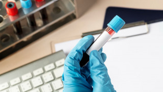 Πρωτοποριακή εξέταση αίματος μπορεί να ανιχνεύσει έγκαιρα πάνω από 50 τύπους καρκίνου