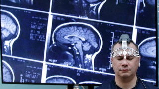 Η εφηβεία του εγκεφάλου διαρκεί μέχρι τα… 32 διαπίστωσε νέα μελέτη