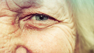 Τα μάτια προειδοποιούν για την άνοια 12 χρόνια από πριν από τη διάγνωση