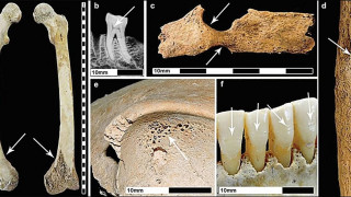 Οι αρχαίοι Ρωμαίοι έκαναν... κακό στην υγεία των Βρετανών - Τι αποκαλύπτει νέα μελέτη