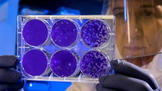 Αυτοί είναι οι πιο επικίνδυνοι ιοί για την υγεία μας το 2026