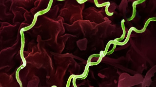 DNA 5.500 ετών δείχνει ότι η σύφιλη έχει τις ρίζες της στην Αμερική — πολύ πριν τον Κολόμβο