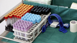 ΠΟΥ: Χαμηλός ο κίνδυνος εξάπλωσης του θανατηφόρου ιού Νίπα έξω από την Ινδία