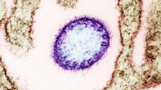 Τι είναι ο ιός Νίπα και πόσο κινδυνεύουμε; Επτά ερωτήσεις - απαντήσεις με όσα πρέπει να ξέρουμε