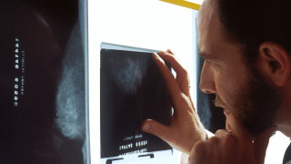 Νέα έρευνα: Το AI προβλέπει σοβαρές καρδιακές παθήσεις στις μαστογραφίες