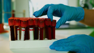 Ένα ακόμη κρούσμα σαλμονέλας στη Λαμία  - Τι έδειξαν τα αποτελέσματα από εργαζόμενους