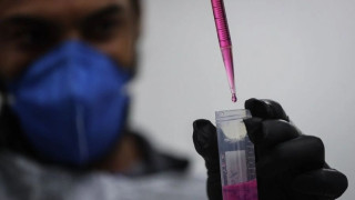 AIDS: Καμπανάκι των ειδικών για «φρένο» στην πρόοδο, εξαιτίας μείωσης των χρηματοδοτήσεων
