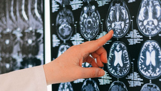 Πρωτοποριακή ανακάλυψη: Ο ανθρώπινος εγκέφαλος αποτελείται από δύο όργανα