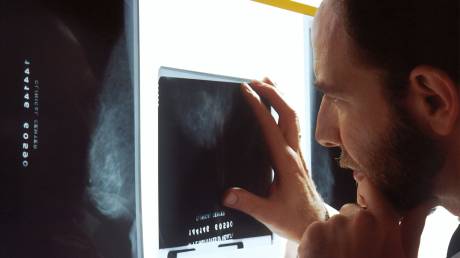 Νέα έρευνα: Το AI μπορεί να προβλέψει σοβαρές καρδιακές παθήσεις στις μαστογραφίες