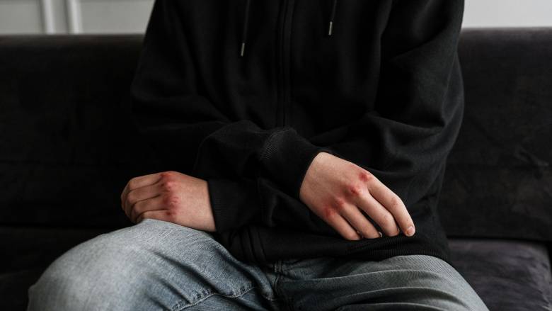 Θύμα ξυλοδαρμού 15χρονος από ανηλίκους στην Πάτρα - Χειροπέδες σε δύο και στους γονείς τους