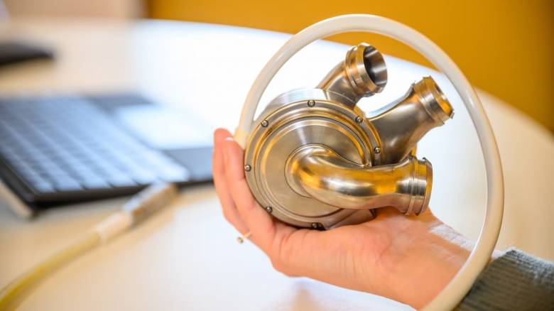 Αυστραλός έσπασε ρεκόρ κρατώντας τεχνητή καρδιά πάνω από 100 μέρες μέχρι να γίνει μεταμόσχευση