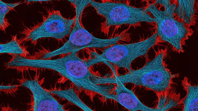 Καρκίνος: Η καινοτομία αλλάζει την ογκολογική φροντίδα και περίθαλψη