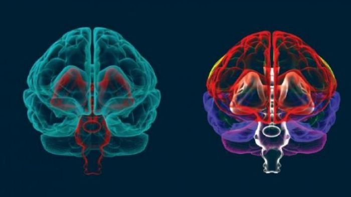 Προηγμένη νευροαπεικόνιση: Πώς αλλάζει τη διάγνωση και πρόγνωση στις κρανιοεγκεφαλικές κακώσεις