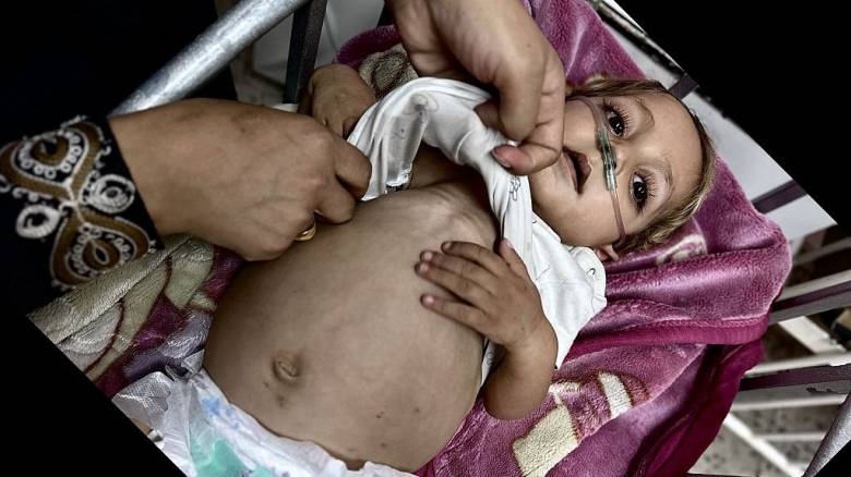 Ατελείωτο ανθρωπιστικό δράμα: «Σταγόνα στον ωκεανό» η βοήθεια – 29 νεκροί από ασιτία σε δύο μέρες