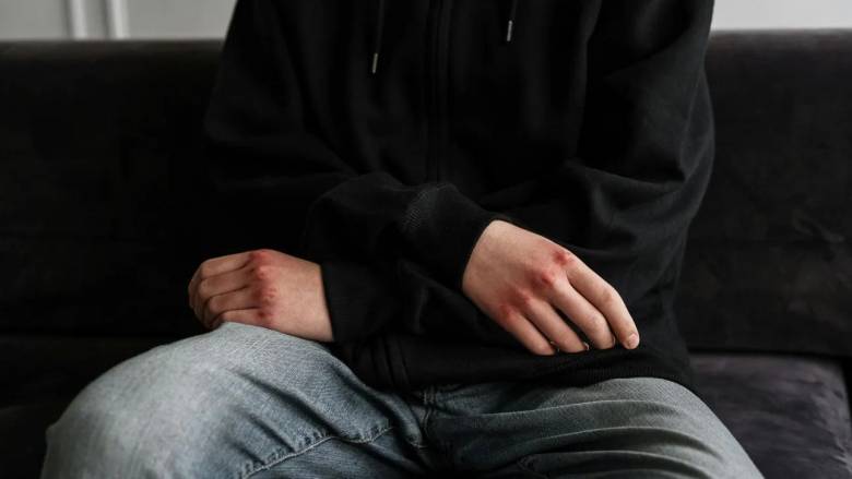 Ιωάννινα: Άγριο επεισόδιο μεταξύ ανηλίκων - Δύο συλλήψεις, ένας στο νοσοκομείο