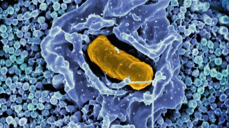 Σαλμονέλα: Σε ποια τρόφιμα εντοπίζεται - Πώς μπορείτε να προστατευτείτε αποτελεσματικά