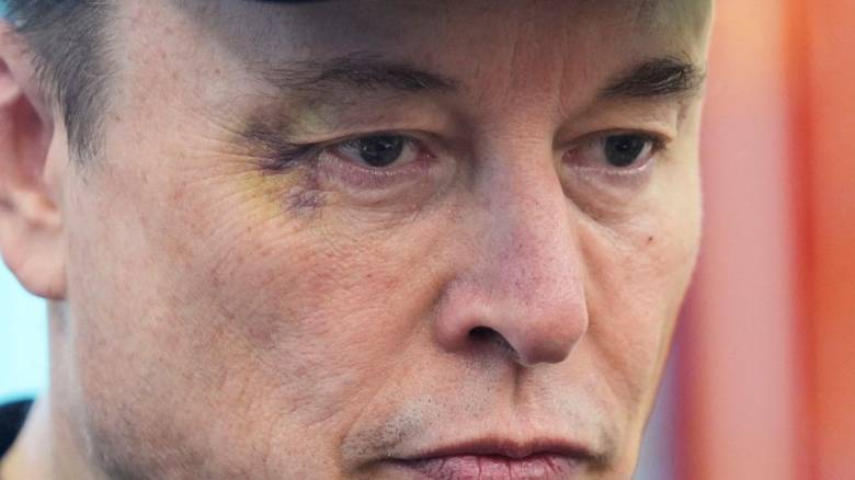 Ο Ίλον Μασκ λέει ότι ο γιος του ευθύνεται για το μελανιασμένο μάτι του