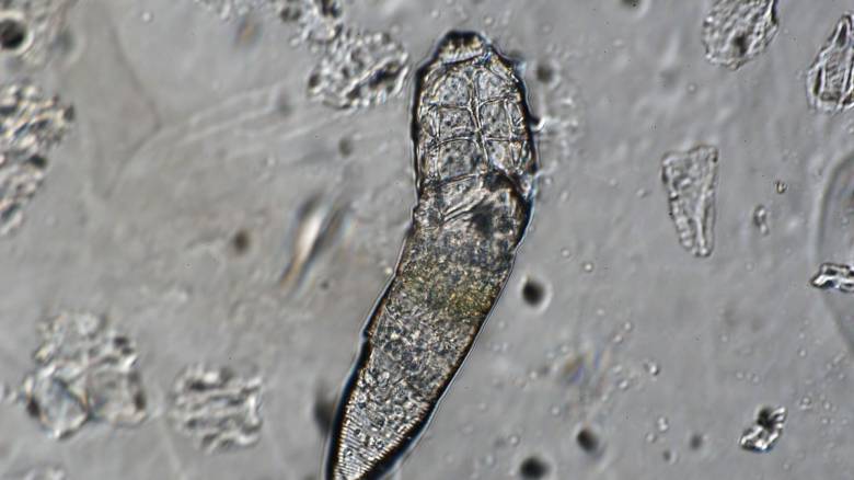 Όταν κοιμόμαστε, αυτά τα μικροσκοπικά πλάσματα κάνουν... πάρτι πάνω στο πρόσωπό μας