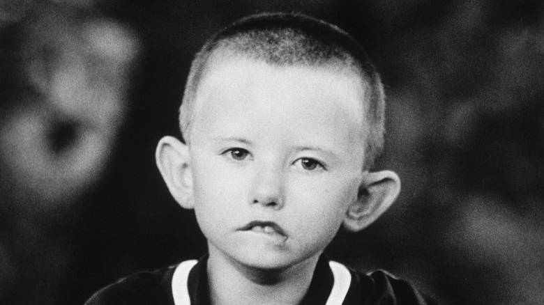 Η σπάνια γενετική διαταραχή που καθιστά τον άνθρωπο ανίκανο να χαμογελάσει