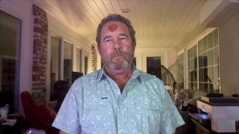 «Aπλά έπεσα»: Τι λέει φωτορεπόρτερ που τραυματίστηκε με πλαστική σφαίρα στο κεφάλι στο Λος Άντζελες