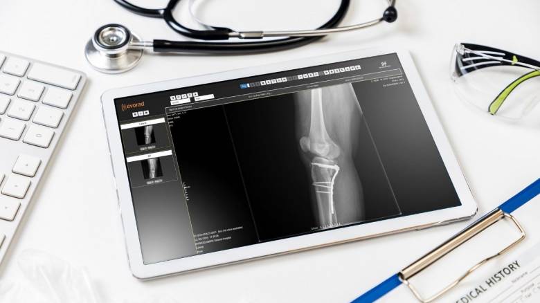 Εθνικός Ηλεκτρονικός Φάκελος Υγείας: Η φροντίδα υγείας ψηφιοποιείται από την COSMOTE TELEKOM