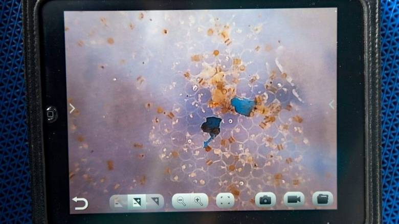 Ποσότητα μικροπλαστικών ισοδύναμη με ένα ολόκληρο πλαστικό κουτάλι βρέθηκε στον ανθρώπινο εγκέφαλο