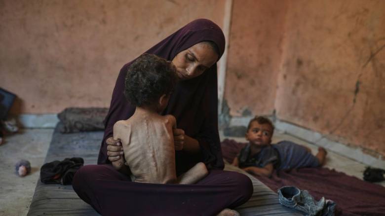 Save the Children: Τα παιδιά στη Γάζα δεν έχουν τη δύναμη να κλάψουν, καθώς ψυχορραγούν