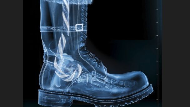 ΣΑΛΟΣ με τον τραυματισμό του Αϊ-Βασίλη! Οι τάρανδοι έτοιμοι να το σκάσουν!