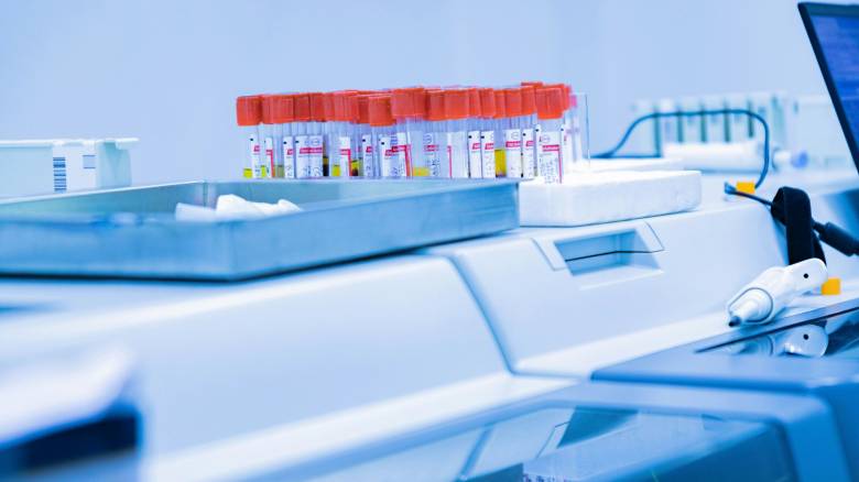 Συνολικά 18 παιδιά γεννήθηκαν στην Ελλάδα από τον δότη σπέρματος με καρκινικό γονίδιο