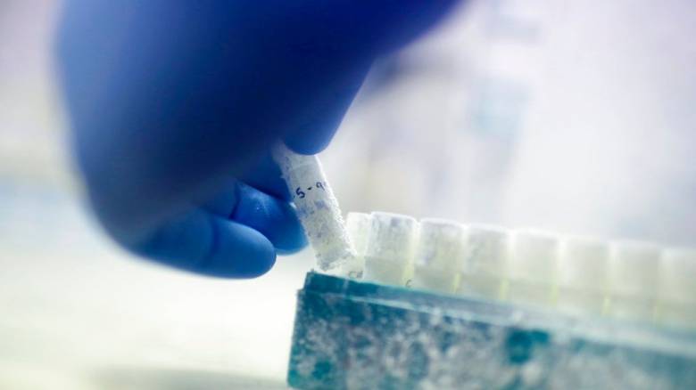 Γονιμοποίηση με δότη σπέρματος: Δεν μηδενίζεται πλήρως ο γενετικός κίνδυνος - Γενετίστρια εξηγεί