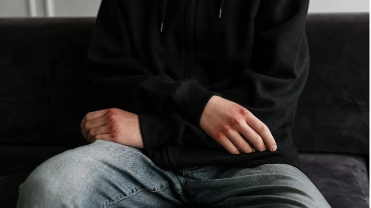 Άγριος ξυλοδαρμός δύο νεαρών από πέντε άτομα στο Αγρίνιο: Οπαδικά τα κίνητρα - Τρεις συλλήψεις