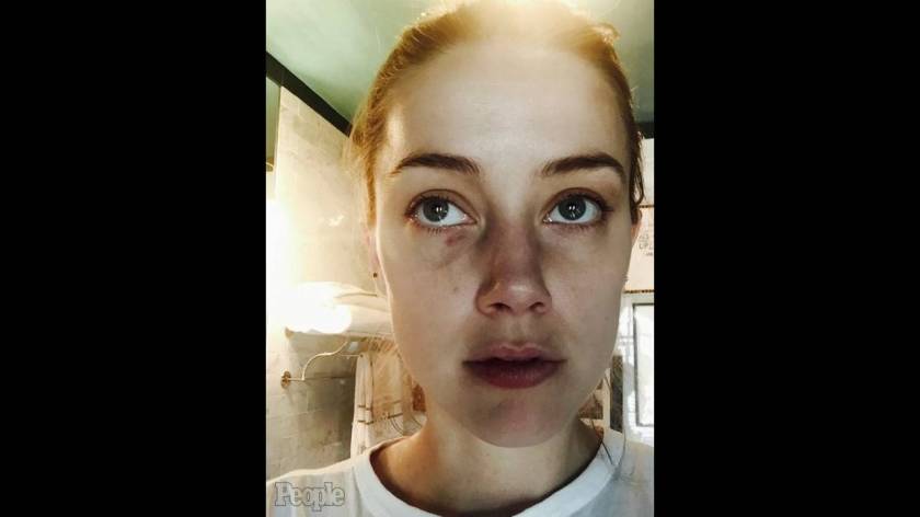 Τα νέα πορτρέτα της κακοποίησης