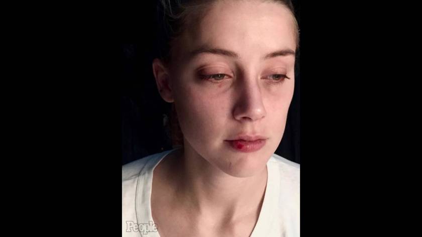 Τα νέα πορτρέτα της κακοποίησης