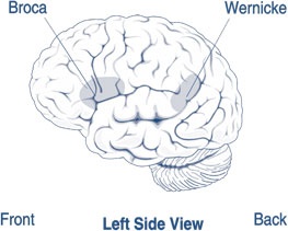 aphasia_broca.jpg