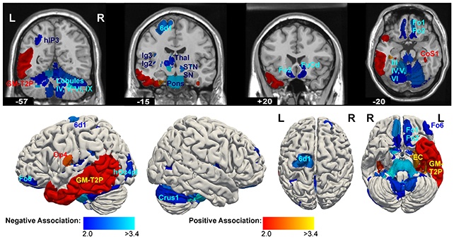brainscans.jpg