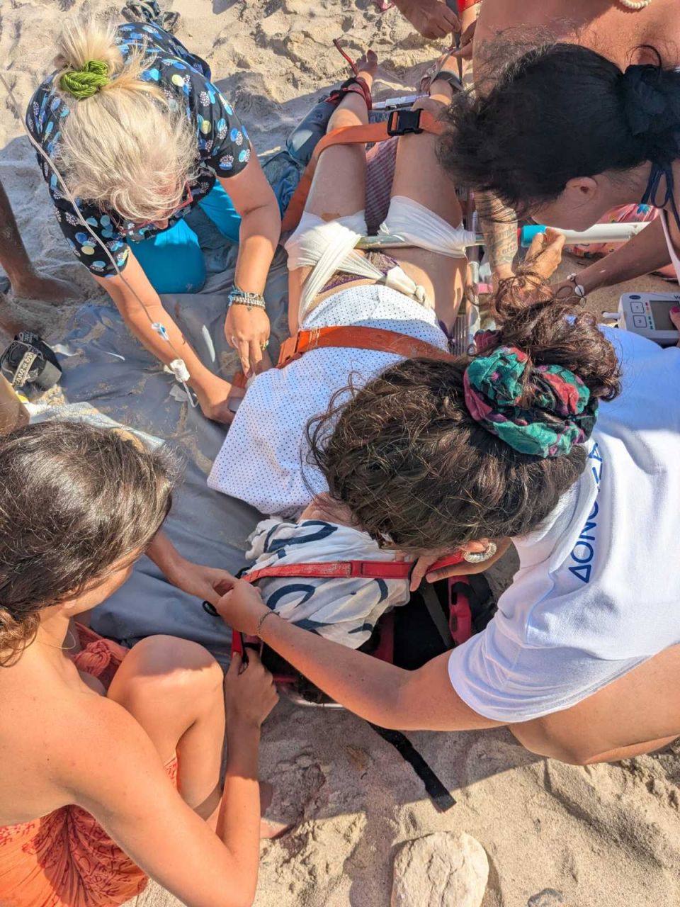 Ομπρέλα καρφώθηκε στο πόδι τουρίστριας στη Δονούσα - Σώθηκε από την άμεση αντίδραση του ΕΚΑΒ donousa omprella touristria