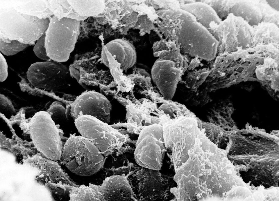 yersinia-pestis-bacteria-photograph-electron-miscroscope.jpg