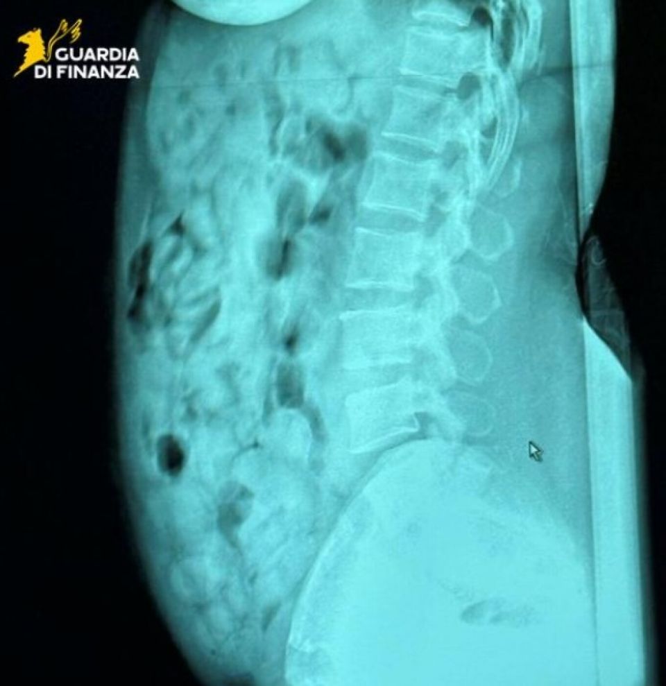 Μπέργκαμο: Συνελήφθη 46χρονη που είχε καταπιεί 120 αμπούλες ηρωίνης narkotika.jpg