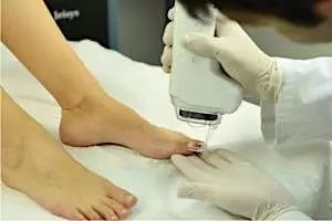 Ξέρεις πώς φεύγουν οι μύκητες από τα νύχια;