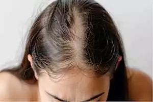 Ξέρεις πώς να επαναφέρεις τον όγκο στα μαλλιά σου;