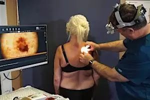 Ξέρεις ότι το μελάνωμα στο δέρμα μπορεί να θεραπευτεί;