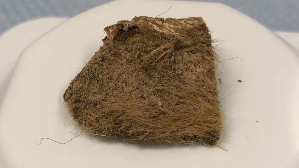 woolly-rhino-tissue-from-stomach.jpg