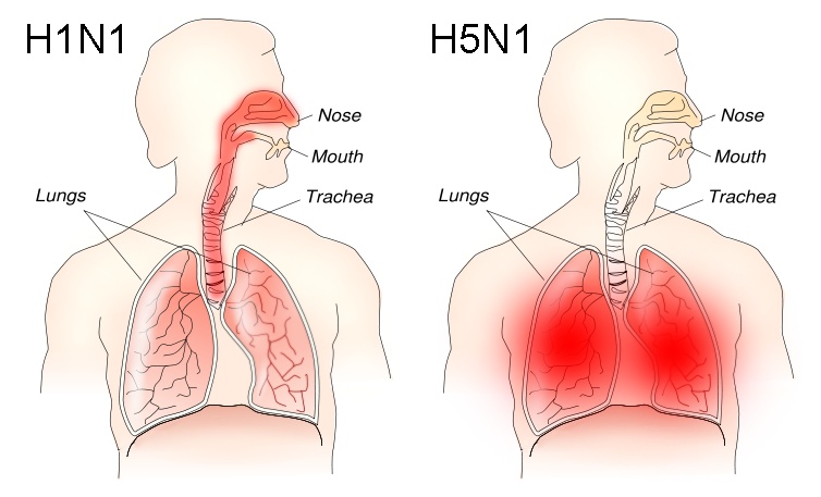 h1n1versush5n1pathology.jpg