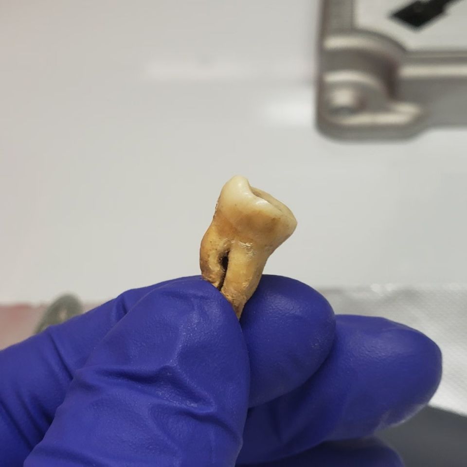 tooth.jpg
